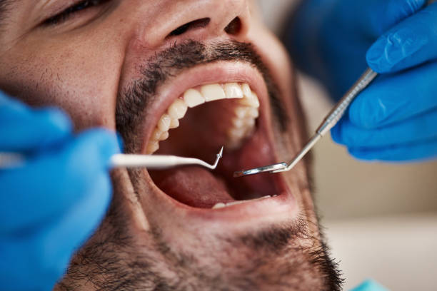 Dental X-Rays and Imaging in Walla Walla East, WA